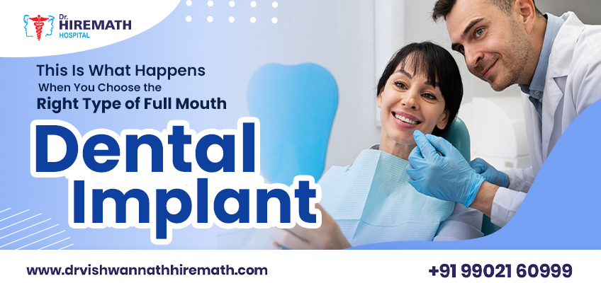 right-type-full-mouth-dental-implants